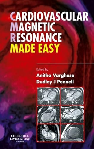 Cardiovascular Magnetic Resonance Made Easy - down 79.16% (£18.99) to £5.00 from £23.99