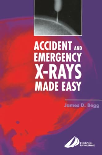 Accident and Emergency X-Rays Made Easy - down 10.02% (£1.33) to £11.94 from £13.27